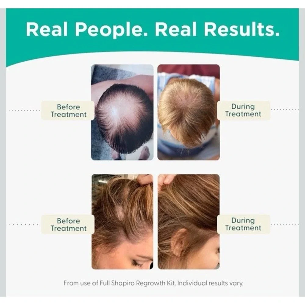 Shapiro MD DHT Fighting Hair Loss Conditioner Triple Action Hair Therapy 8 oz